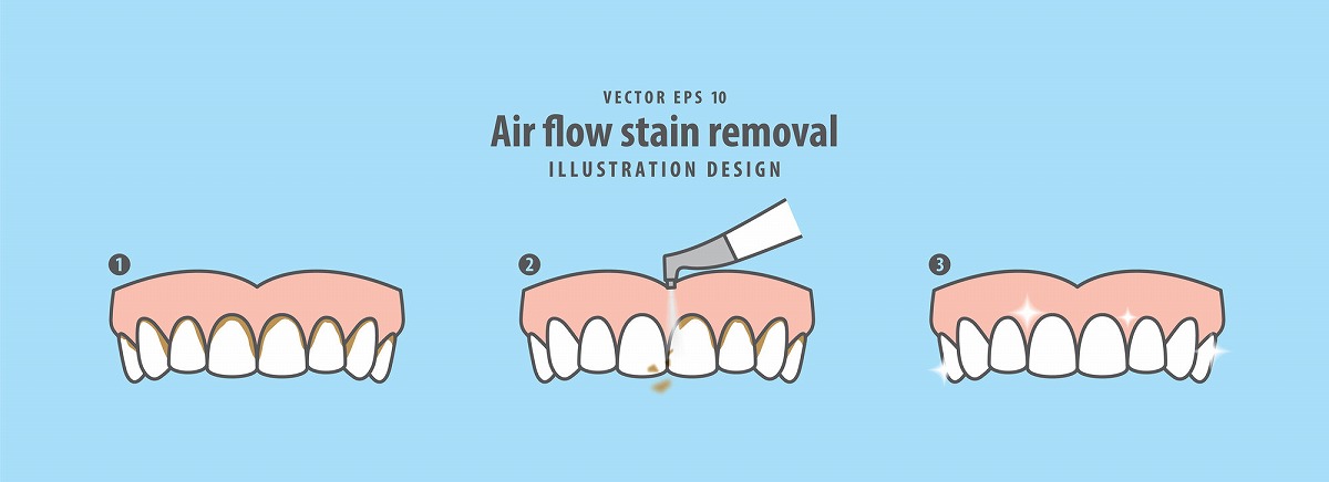 エアフロークリーニングに対応しています