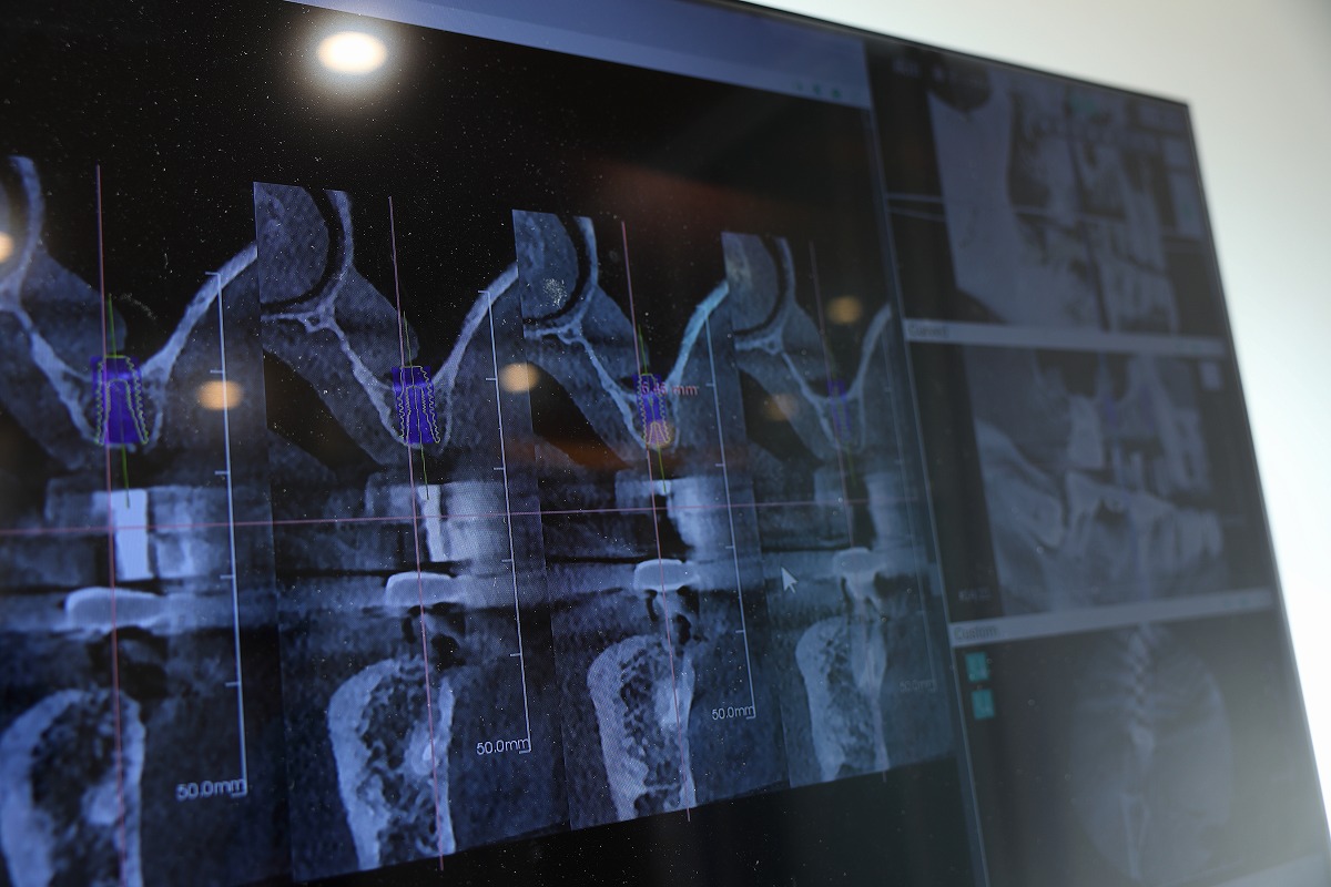 「サージカルガイド」を使用する理由