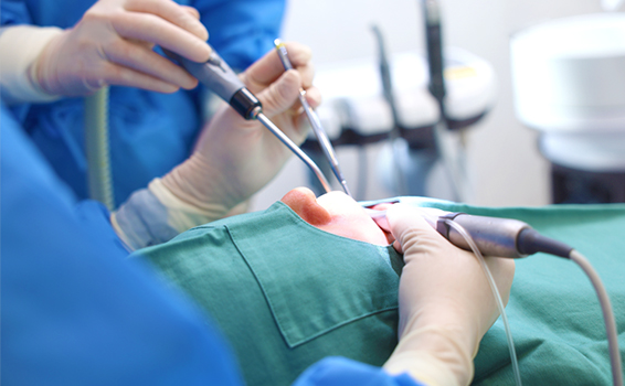 歯ぐきが痩せてしまった方へ 見た目を整える「歯周形成外科」